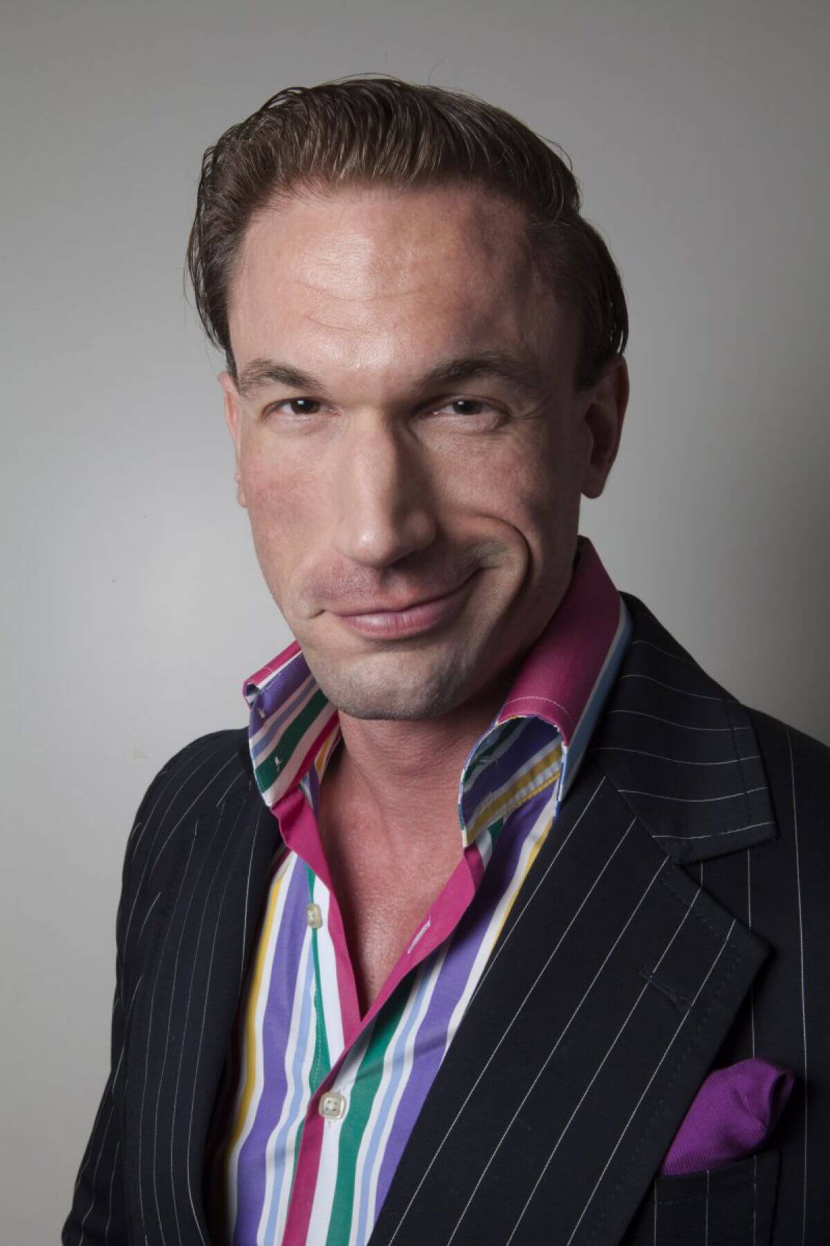 Dr Christian Jessen Hair Transplant Case Study Crown Clinic