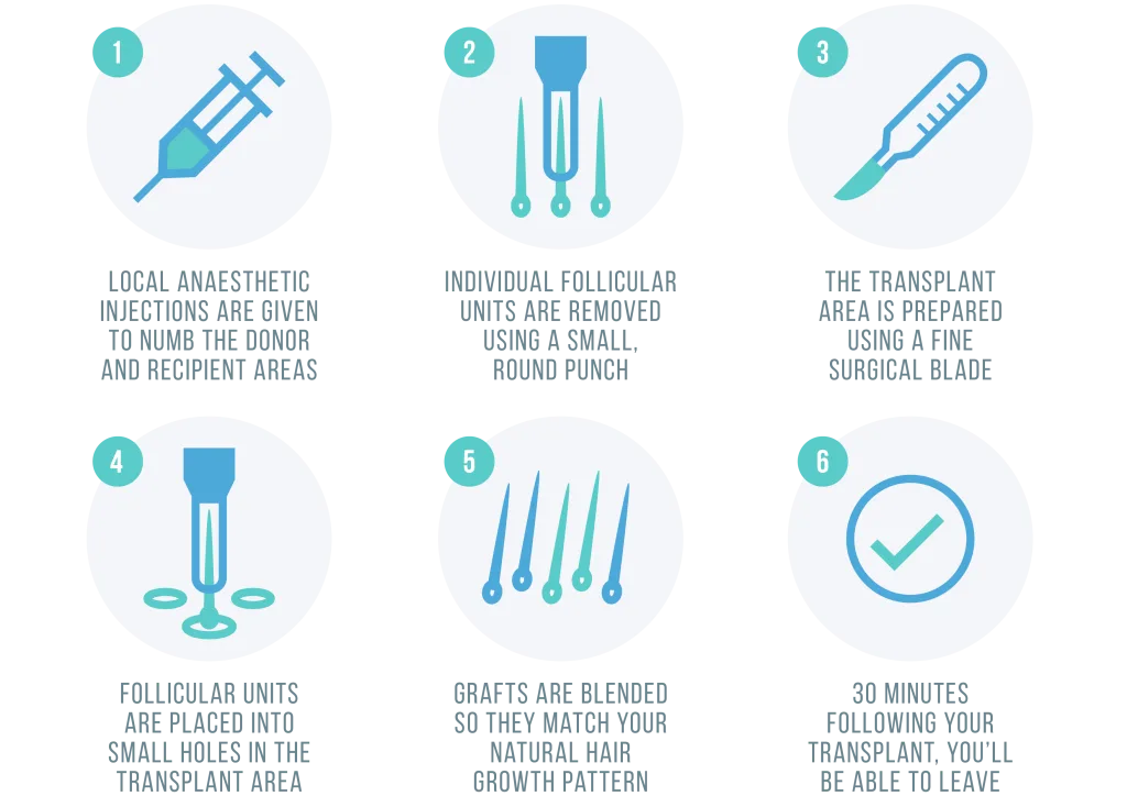 The FUE process explained
